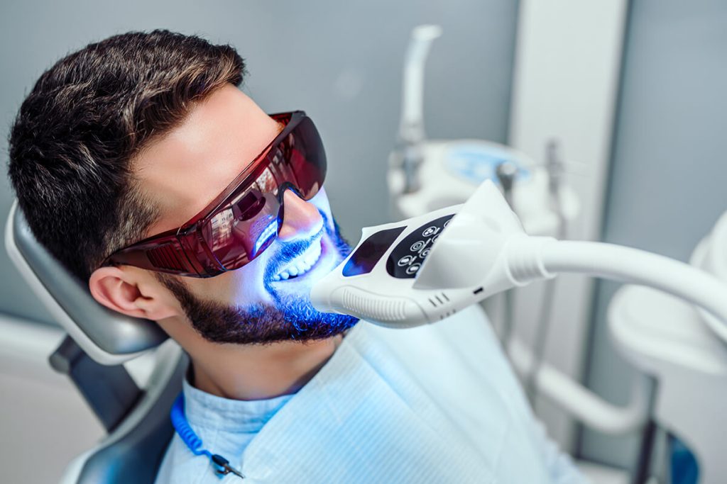 Lunchtime-Teeth-Whitening-in-Toronto-Achieve-a-Brighter-Smile-on-Your-Break