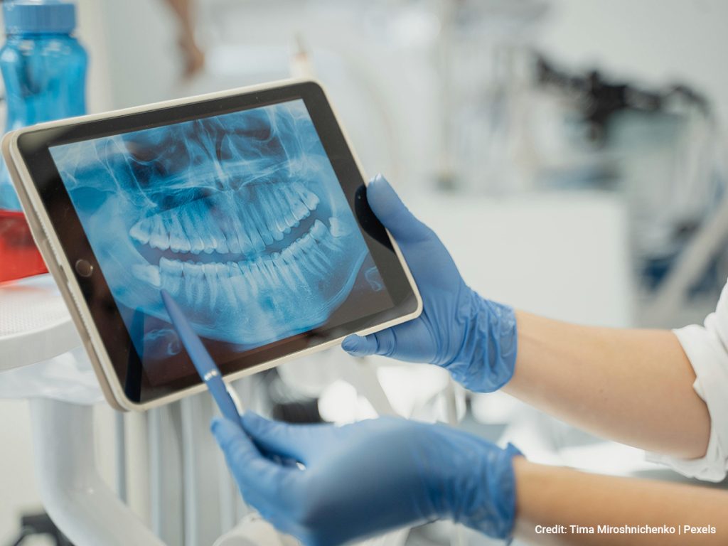 Preparing-for-a-Dental-X-Ray-What-to-Expect