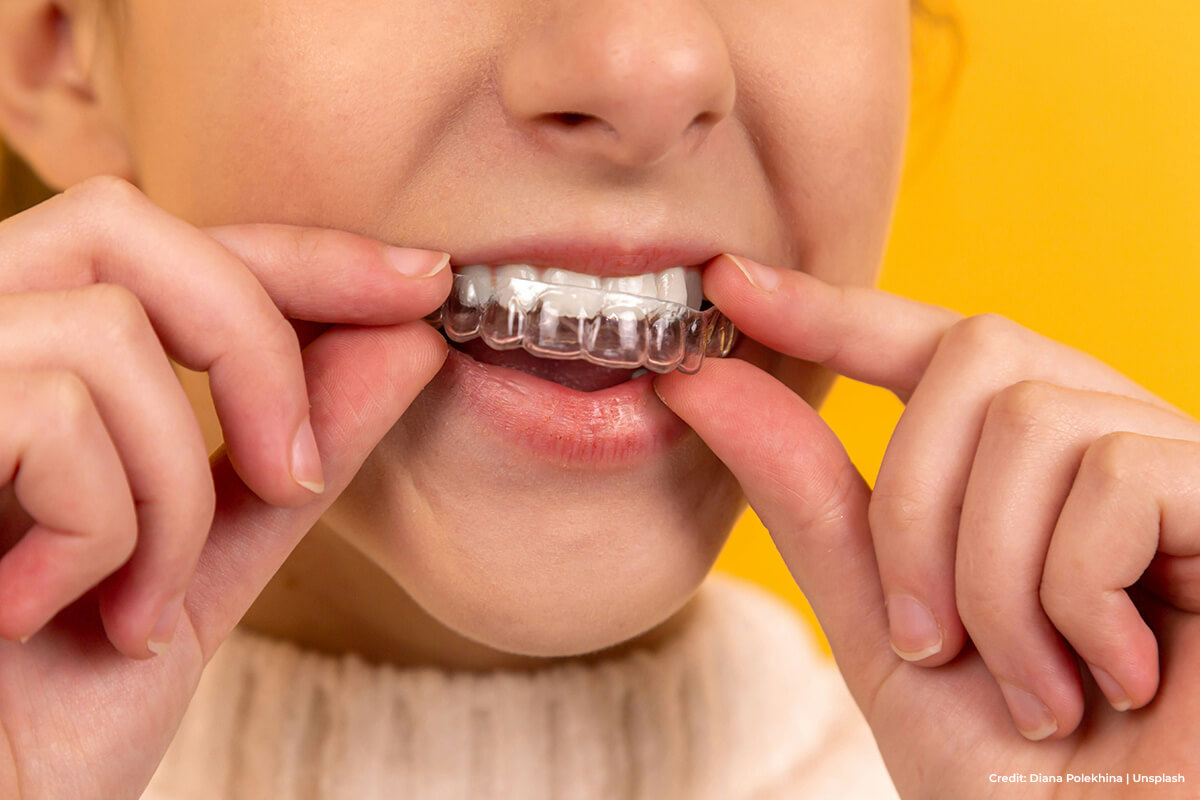 Life-with-Invisalign