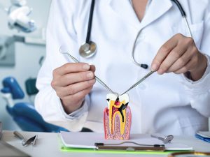 Root-Canal-Warning-Signs-Pain-Swelling-and-Other-Indicators