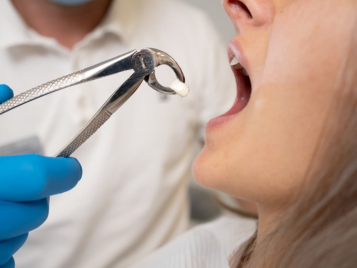 The-Wisdom-Tooth-Extraction-Procedure-What-to-Expect
